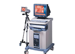 电子数码阴道镜